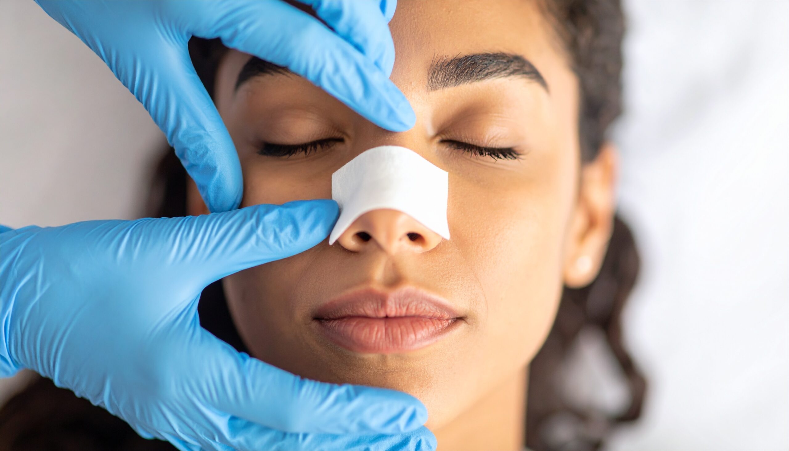 Rhinoplasty side profile