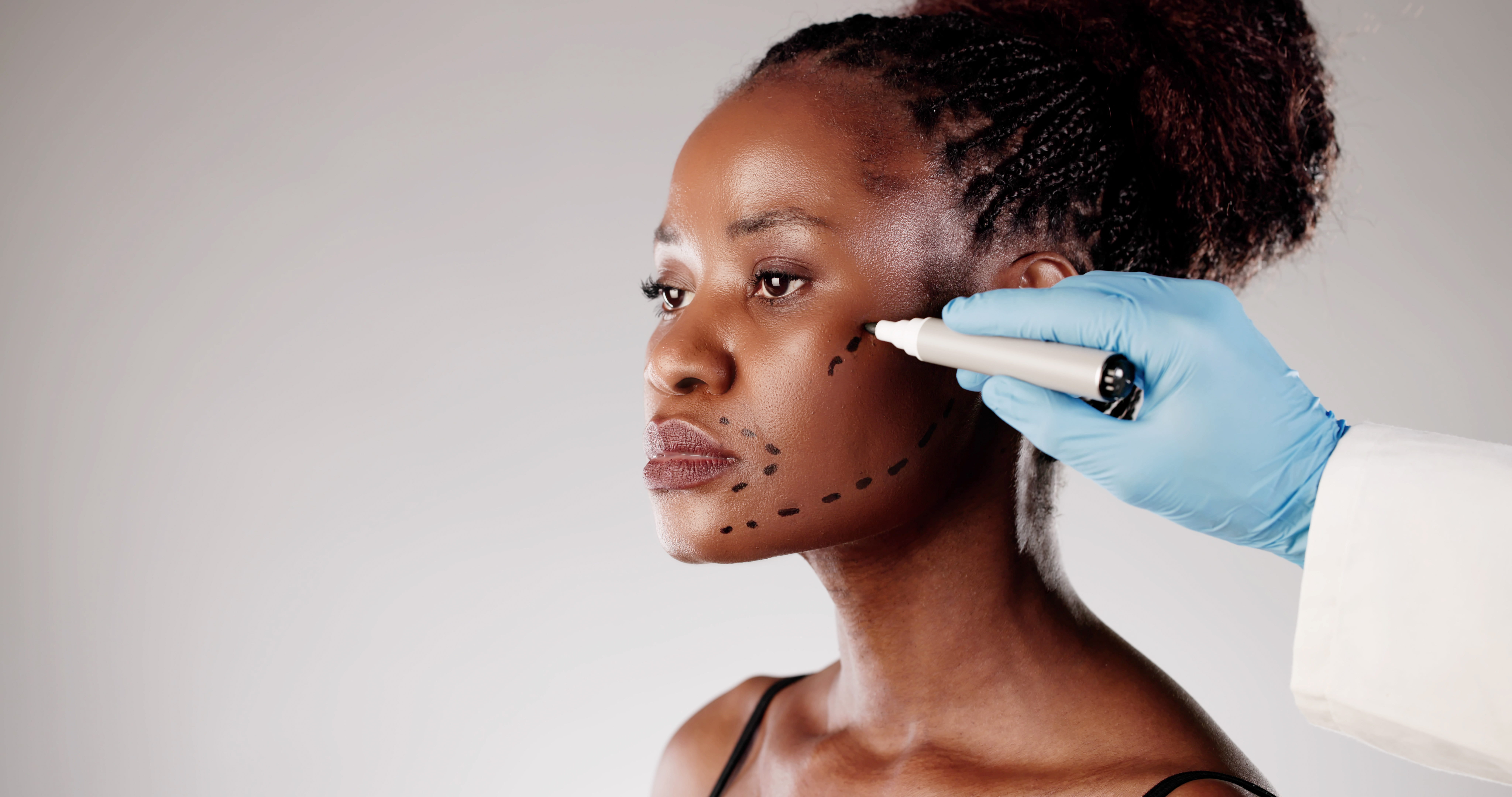 Face lift (rhytidectomy) procedure concept image for facial rejuvenation